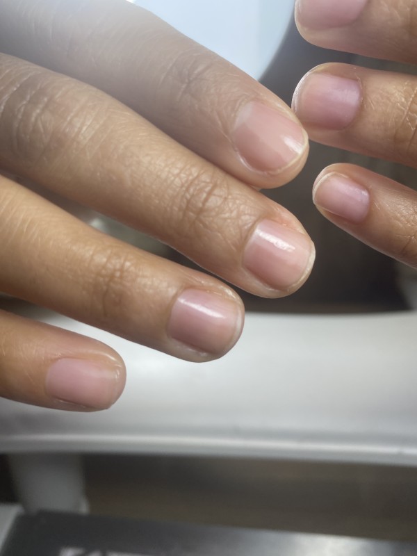 Faire une dépose complète en urgence d'un semi permanent ou d'extensions à Bordeaux proche de L'hôpital Pellegrin