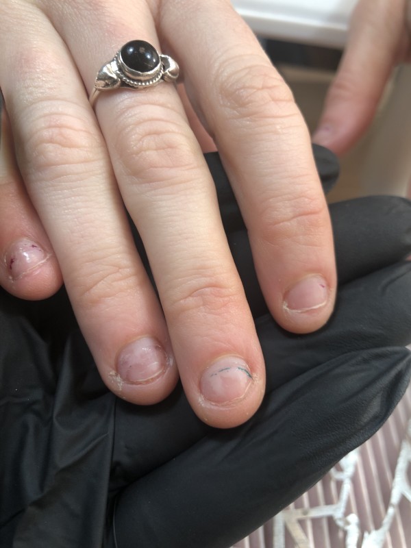 Une solution pour les ongles très rongés à Bordeaux proche du centre-ville